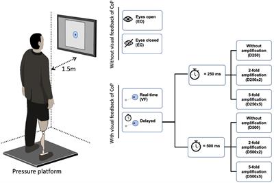 Influence of Augmented Visual Feedback on Balance Control in Unilateral Transfemoral Amputees